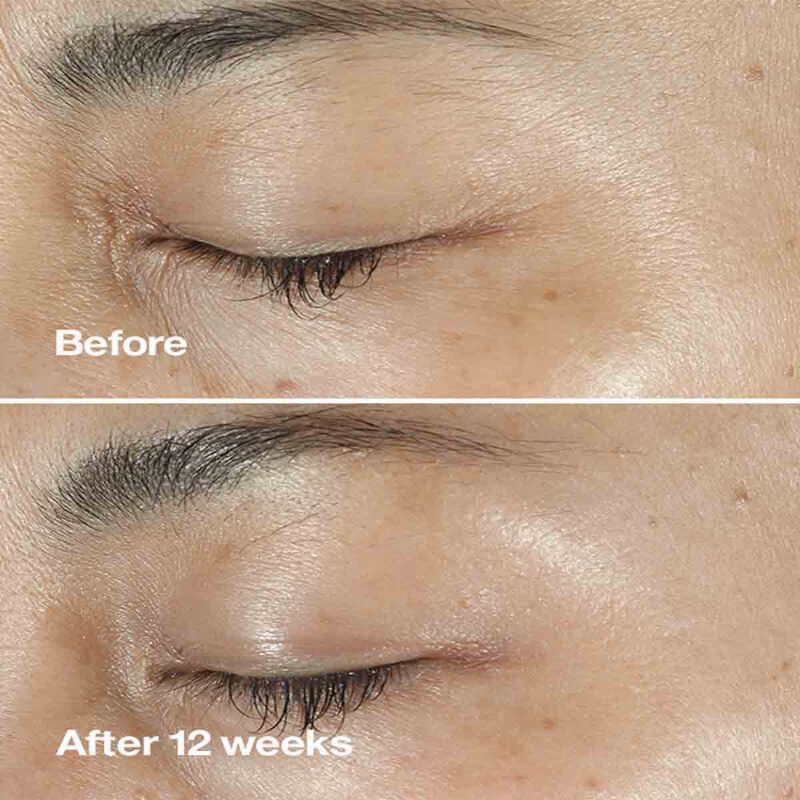 Clinique Smart Clinical Repair Wrinkle Correcting Serum Clinique Smart Clinical Repair Wrinkle Correcting Serum
