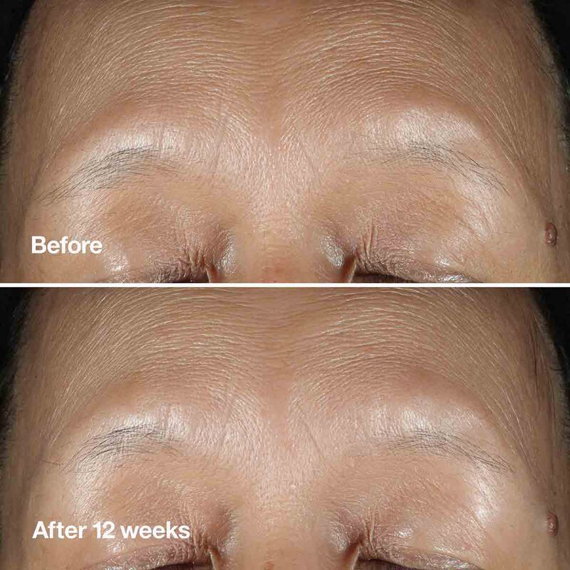 Clinique Smart Clinical Repair Wrinkle Correcting Serum Clinique Smart Clinical Repair Wrinkle Correcting Serum
