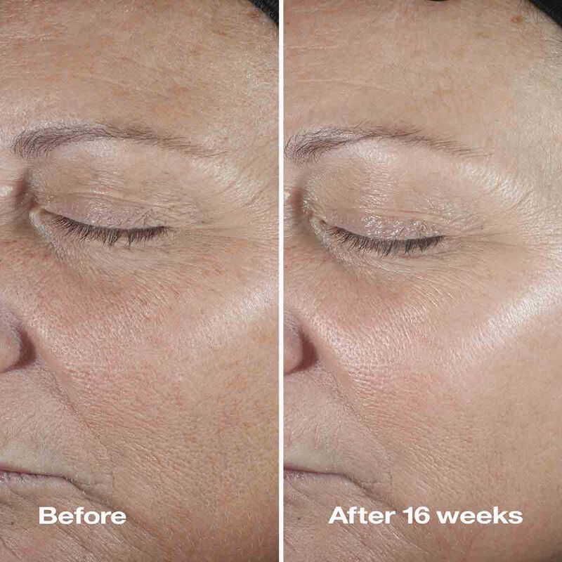 Clinique Smart Clinical Repair Wrinkle Correcting Serum Clinique Smart Clinical Repair Wrinkle Correcting Serum
